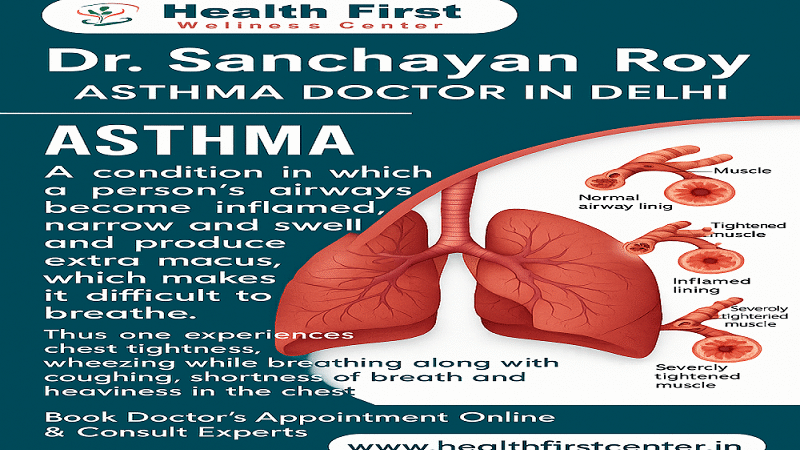 Find an Asthma Specialist Who Truly Understands Your Needs: Dr. Sanchayan Roy