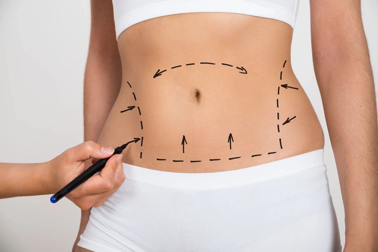 Who is the top Fat Dissolving Injection provider in Dubai? 1 Who is the top Fat Dissolving Injection provider in Dubai?