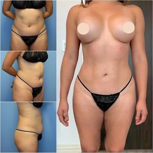 Top Benefits of Working with the Best Body Contouring Surgeon in dubai 1 Top Benefits of Working with the Best Body Contouring Surgeon in dubai