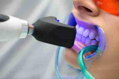 5 Safe Methods to Achieve a Brighter, More Confident Smile