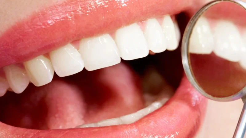 Is a Porcelain Veneer Specialist the Right Choice for Your Cosmetic Needs?