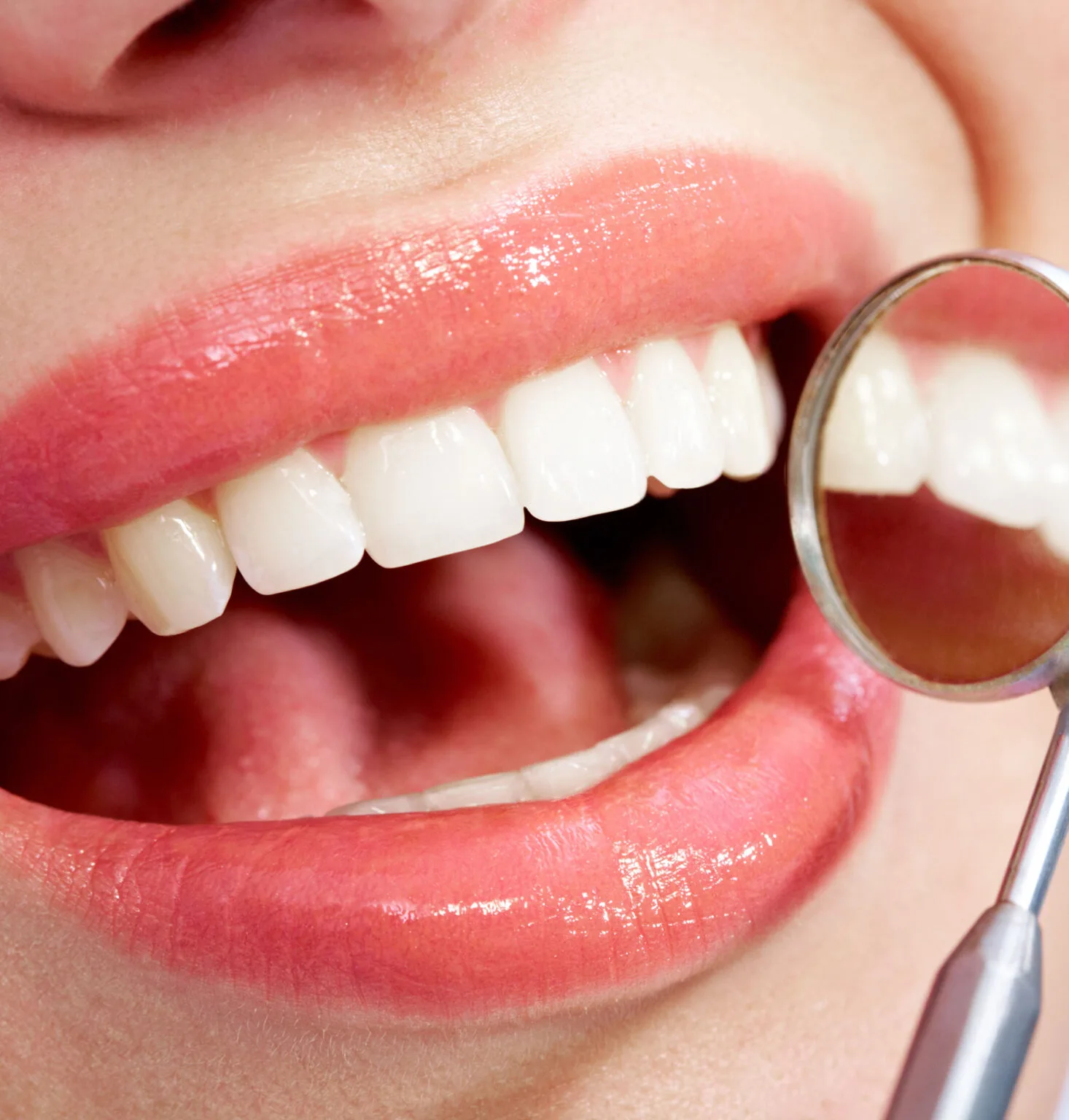 Is a Porcelain Veneer Specialist the Right Choice for Your Cosmetic Needs? 1 Is a Porcelain Veneer Specialist the Right Choice for Your Cosmetic Needs?