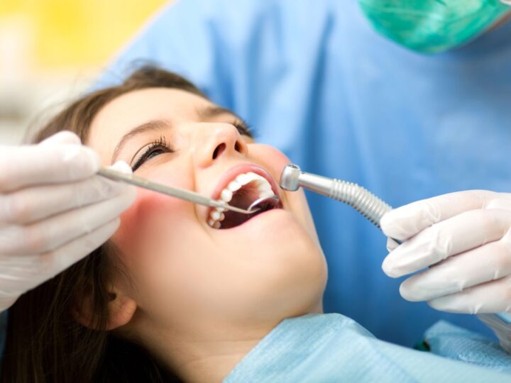 What Is the Cost of Composite Fillings in Houston?