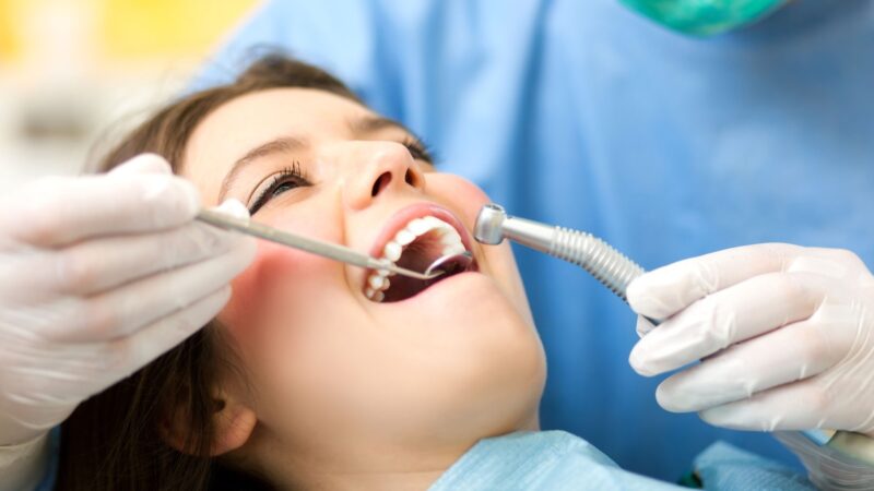 What Is the Cost of Composite Fillings in Houston?