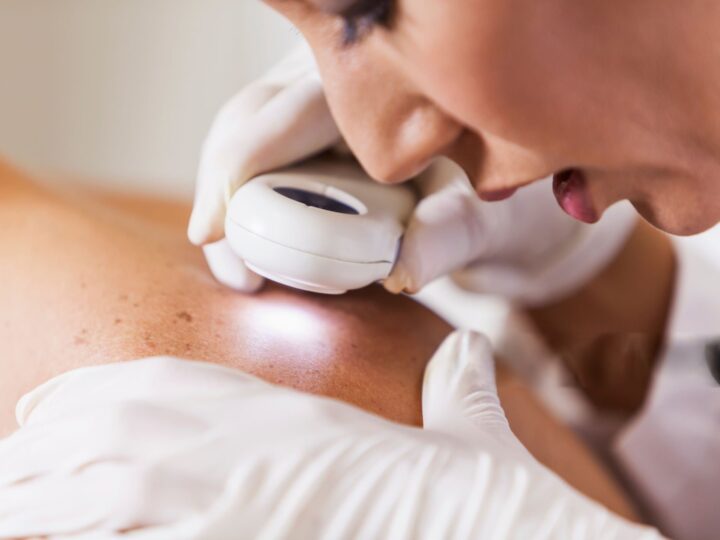 The Rising Risk Of Skin Cancer In Orlando: How Regular Dermatology Visits Can Help