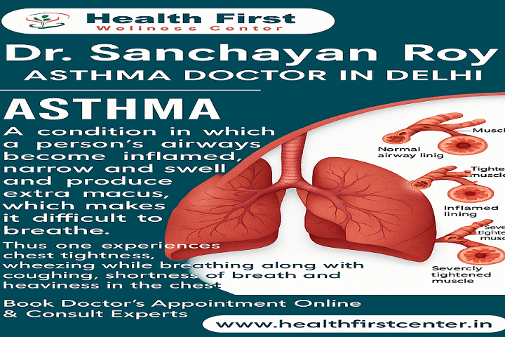 Asthma Specialist Doctor Near Me: When to Seek Expert Help