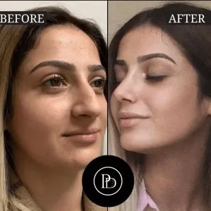 PRP Treatment in Dubai: The Natural Way to Restore Youth 1 PRP Treatment in Dubai: The Natural Way to Restore Youth