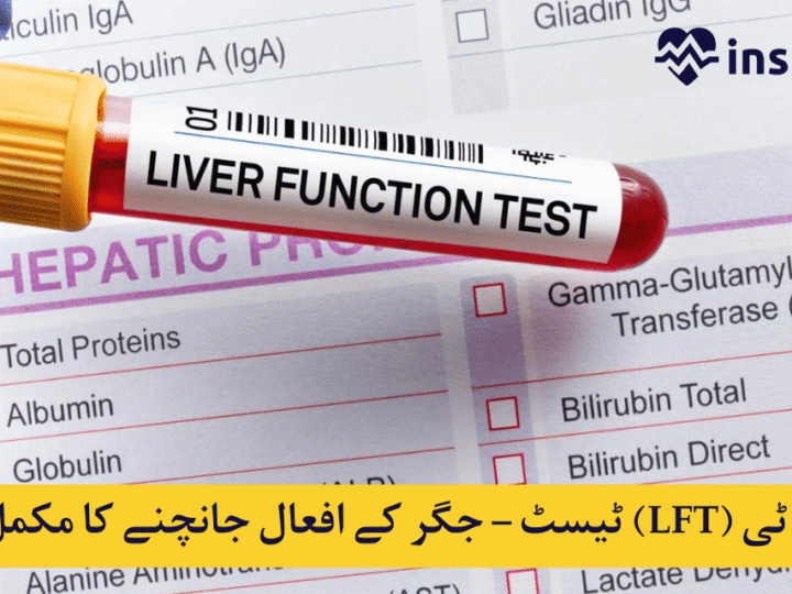 Liver Function Test (LFT): What It Is?