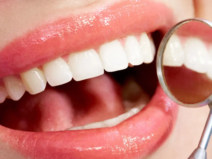 Why Should You Choose a Veneer Specialist Over a General Dentist?