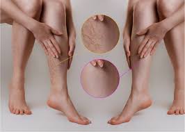 What is a vein specialist called in medical terms? 1 What is a vein specialist called in medical terms?