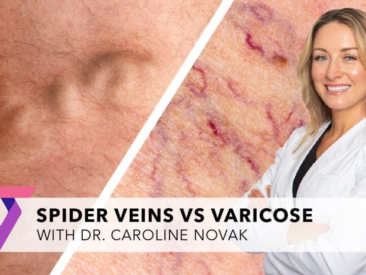 Should You Visit a Vein Specialist or a Cardiologist for Varicose Veins?