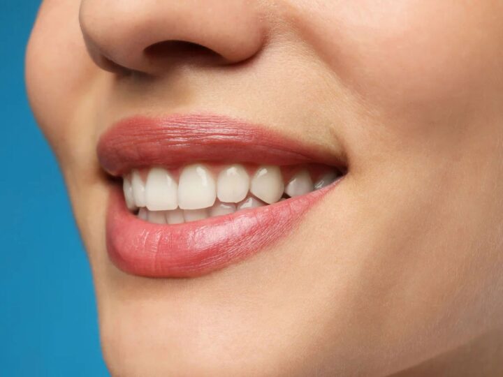 How Can Houston Cosmetic Dentists Improve Your Smile?