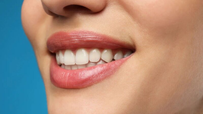 How Can Houston Cosmetic Dentists Improve Your Smile?