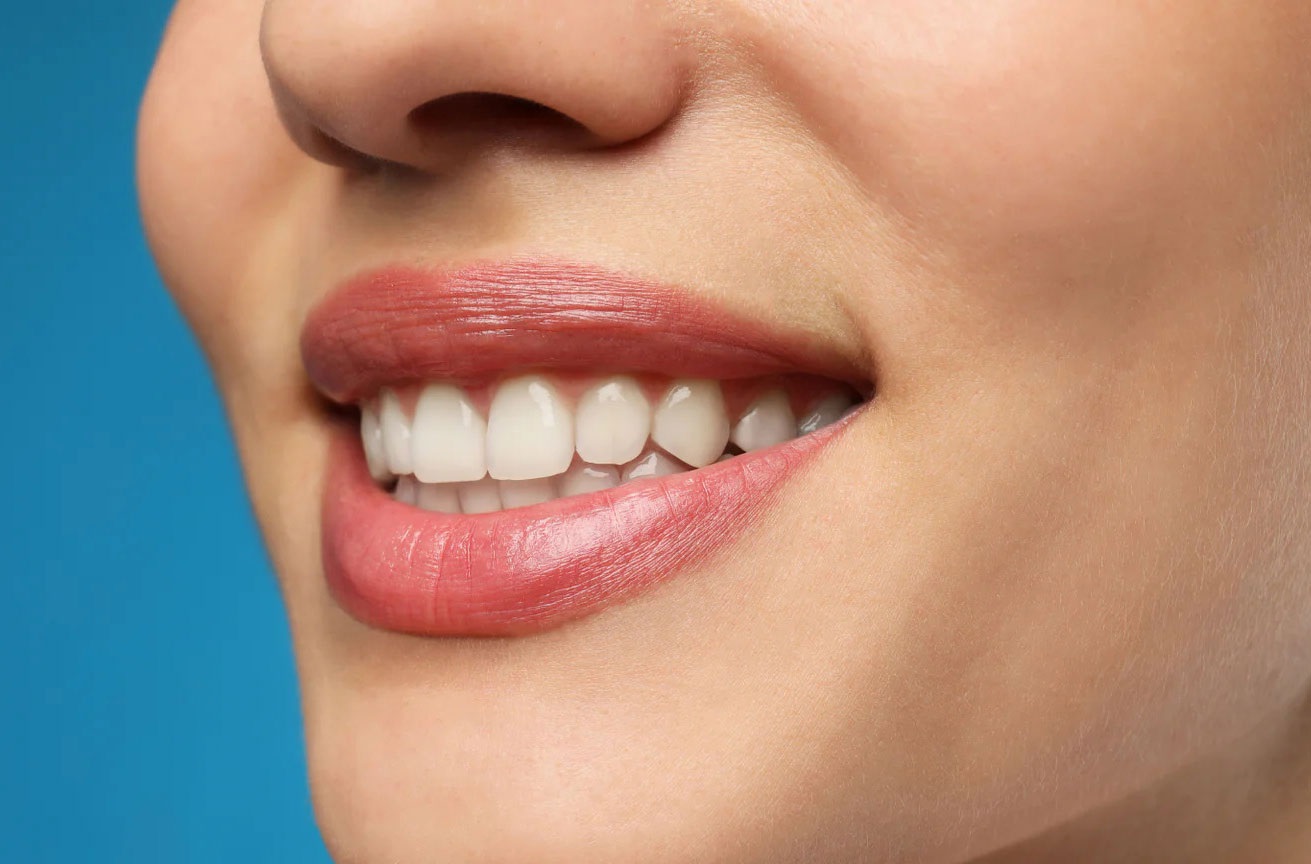 How Can Houston Cosmetic Dentists Improve Your Smile?