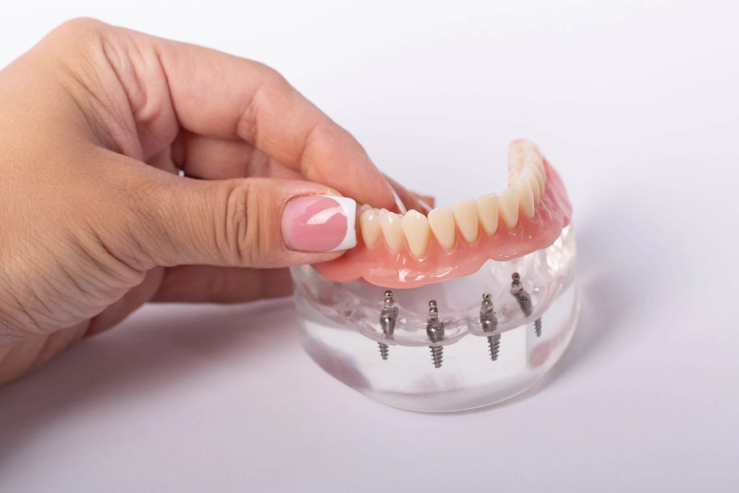 Are Discount Dentures a Good Alternative to Traditional Dentures?