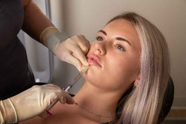 First-Time Lip Fillers: What to Expect and How to Prepare 3 Lip dentist