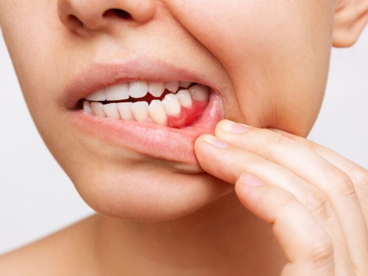When Should You See a Dentist for a Tooth Infection?