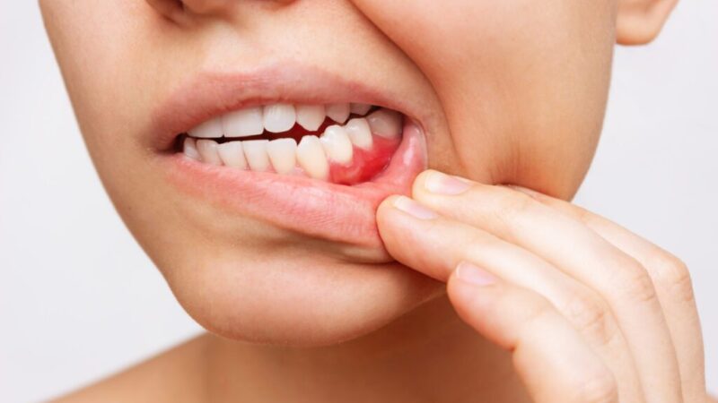 When Should You See a Dentist for a Tooth Infection?