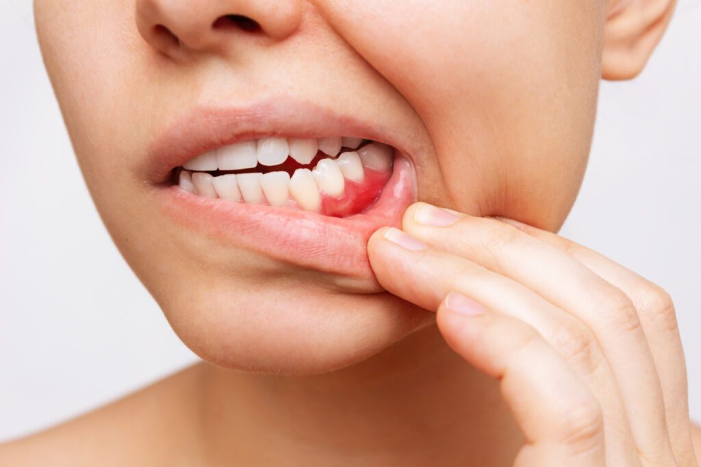 When Should You See a Dentist for a Tooth Infection?