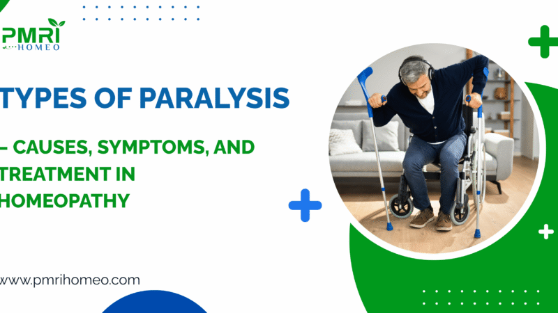 Types of Paralysis — Causes, Symptoms, and Treatment in Homeopathy