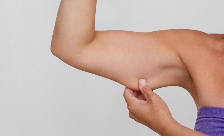 How Arm Toning Treatment Helps You Love Your Reflection