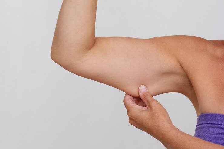 How Arm Toning Treatment Helps You Love Your Reflection 1 How Arm Toning Treatment Helps You Love Your Reflection