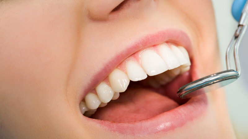 What Makes a Veneer Specialist Different from a General Dentist?