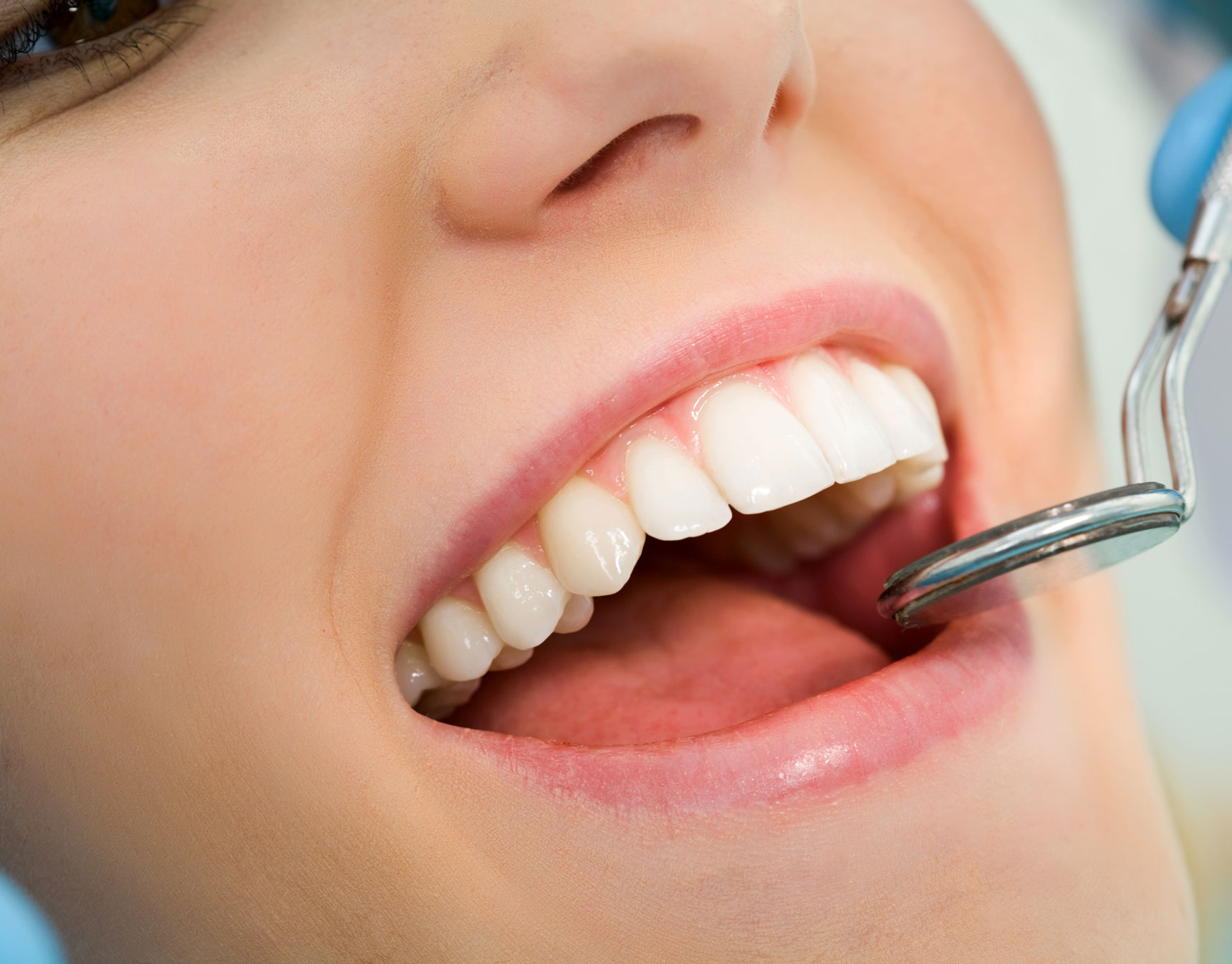 What Makes a Veneer Specialist Different from a General Dentist?
