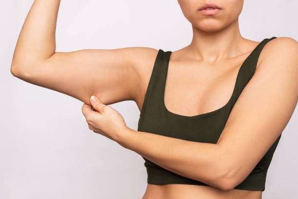 How Arm Toning Treatment Helps You Love Your Reflection 3 image 32