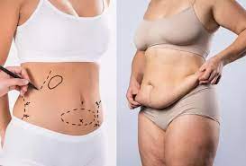 Latest Technology in Plastic Surgery in Islamabad Clinics 1 Latest Technology in Plastic Surgery in Islamabad Clinics
