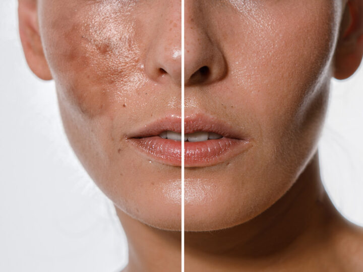 Islamabad Can Transform Your Skin Safely and Effectively