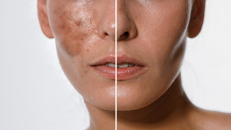 Islamabad Can Transform Your Skin Safely and Effectively