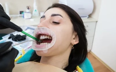 Are There Emergency Dental Services in Albany WA?