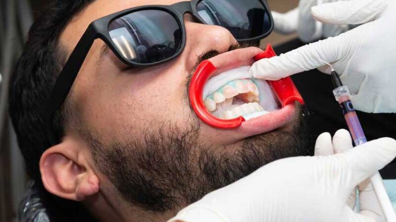 How Do You Choose the Right Cosmetic Dentist in Houston?