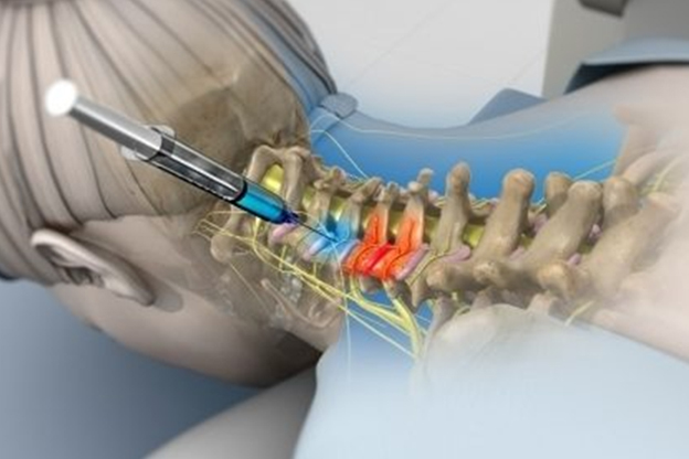Nerve Block Injection in Salem, NH: Effective Pain Relief at Advance Health Solutions