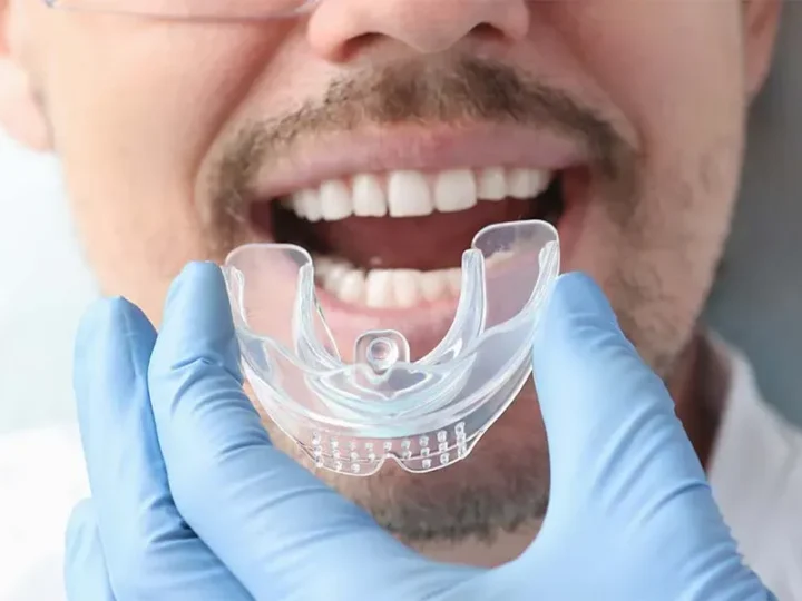 What Are the Benefits of Visiting an Invisalign Dentist?