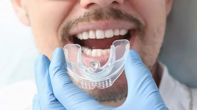 What Are the Benefits of Visiting an Invisalign Dentist?