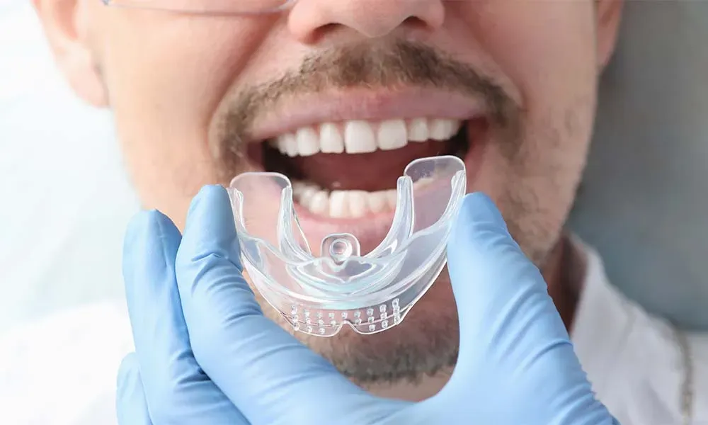 What Are the Benefits of Visiting an Invisalign Dentist?
