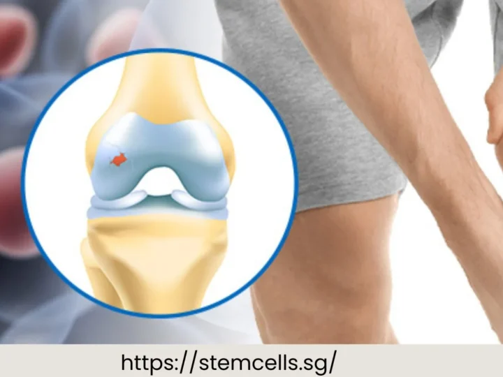 Breaking New Ground: How Stem Cell Therapy in Singapore is Shaping the Future of Regenerative Medicine