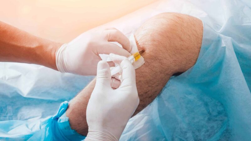 What Are the Latest Treatments Offered by Knee Pain Doctors in Fidi?