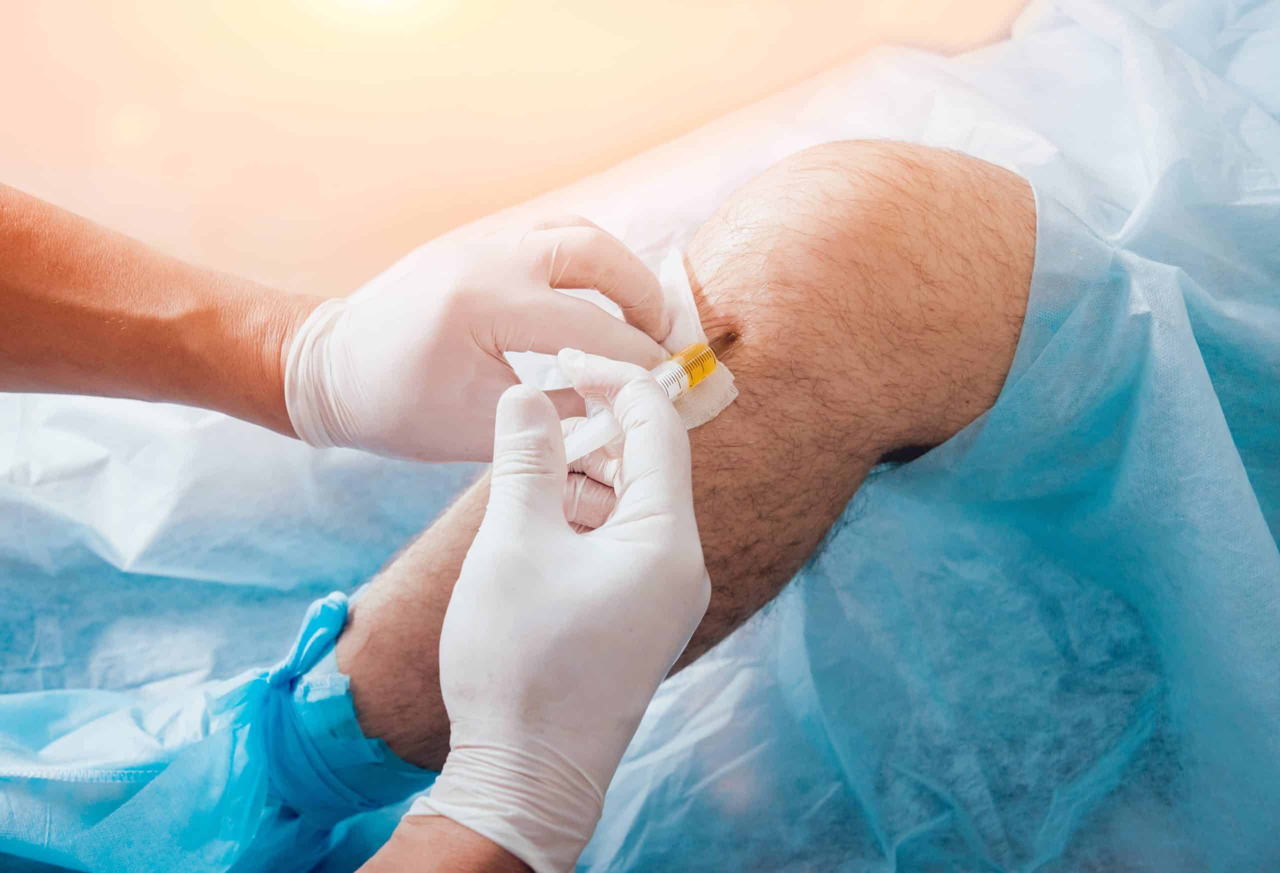 What Are the Latest Treatments Offered by Knee Pain Doctors in Fidi?