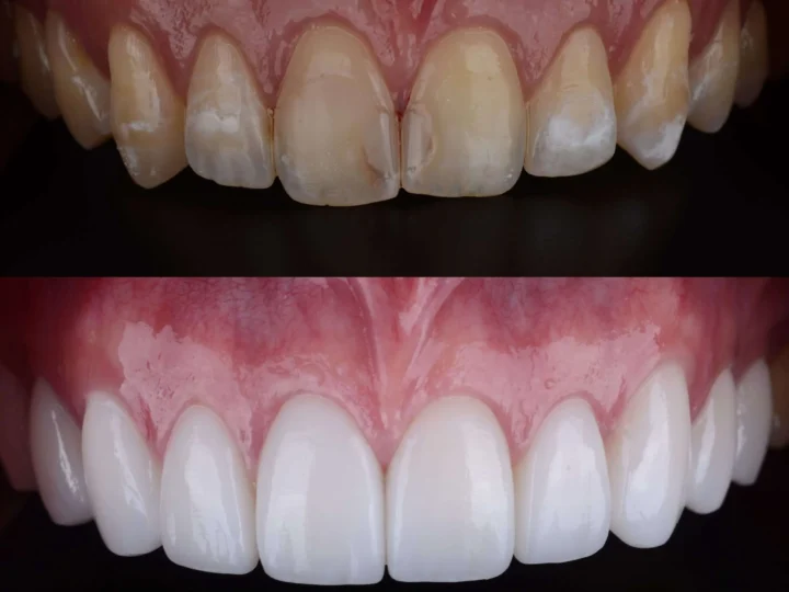 The Science of Whitening Ingredients: What Really Works