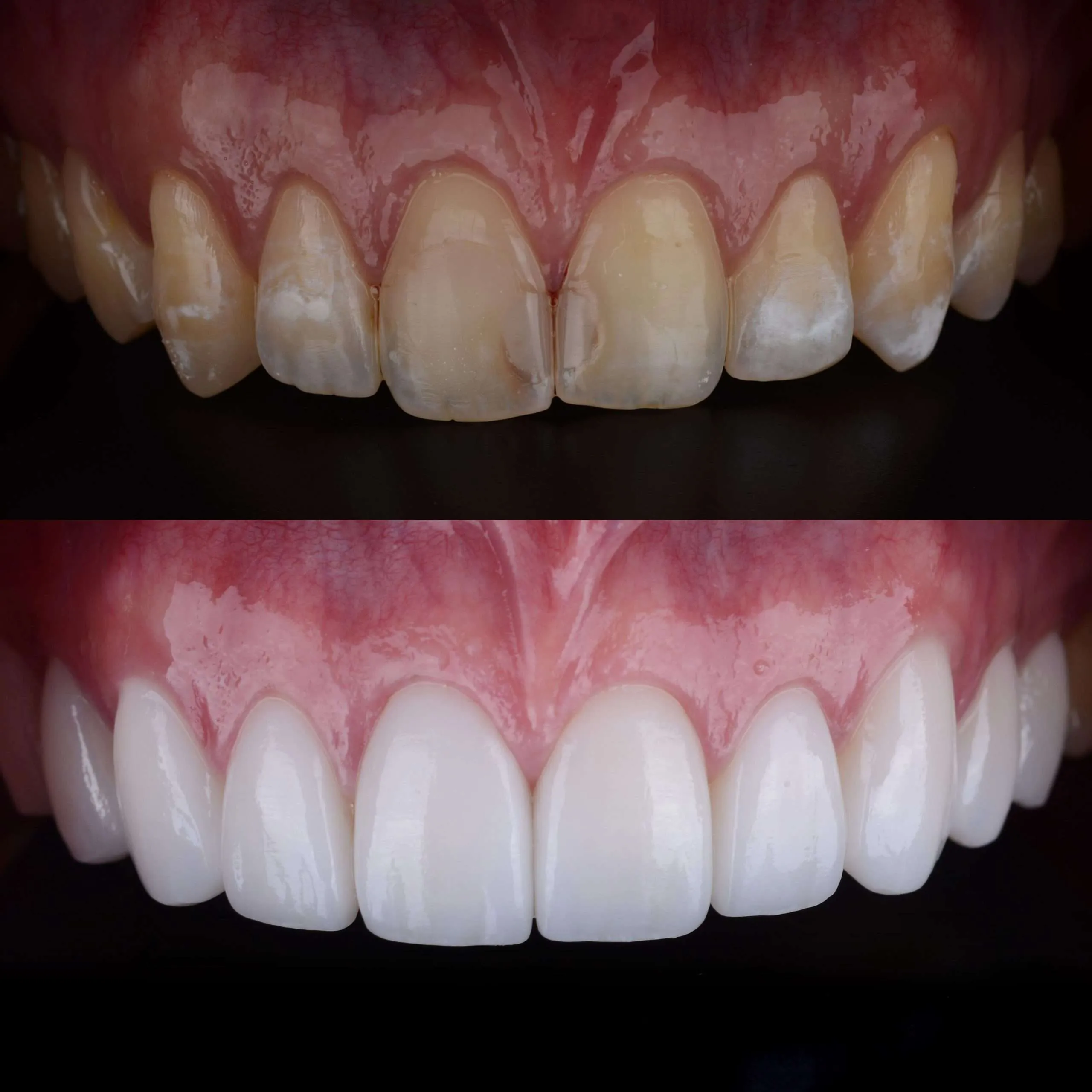 The Science of Whitening Ingredients: What Really Works