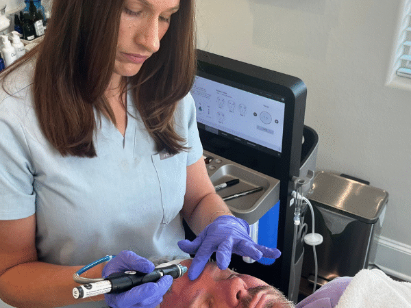 5 Benefits of HydraFacial vs. Chemical Peel in Tyler