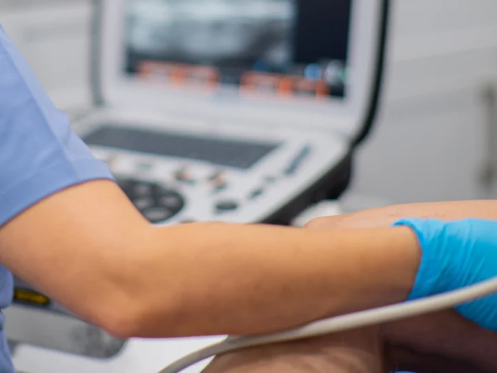 What to Expect During Your First Visit to a Vein Specialist?