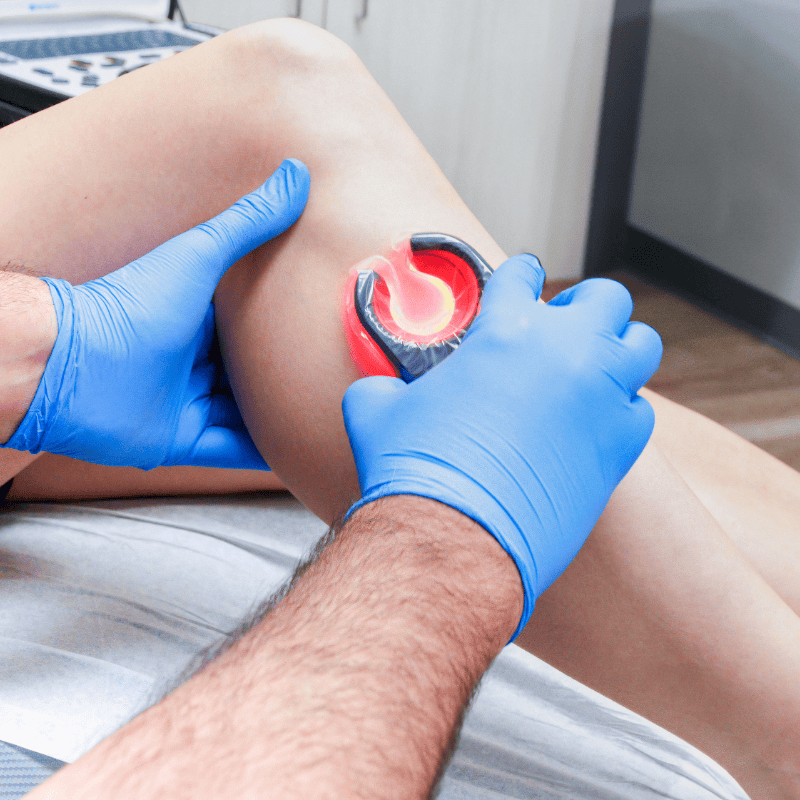 How Effective Are Treatments at a Vein Treatment Center?