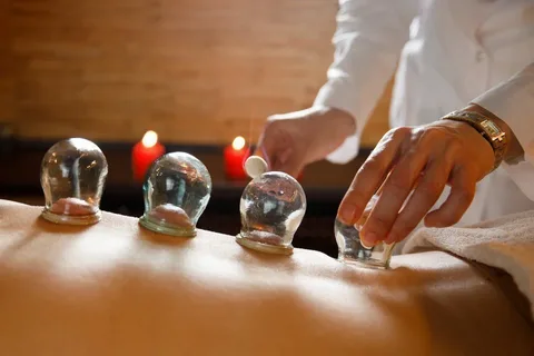 When Did Cupping Therapy Arrive in Montreal?