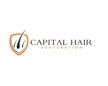 Capital Hair Restoration - Hair Transplant