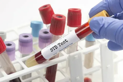 Private and Confidential STD Test in Dubai: Your Guide to Safe and Responsible Healthcare